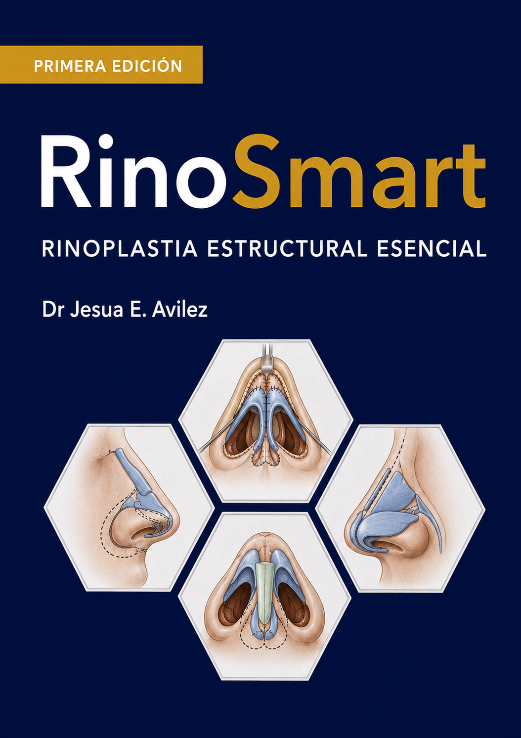 RinoSmart — Rinoplastia Estructural Esencial